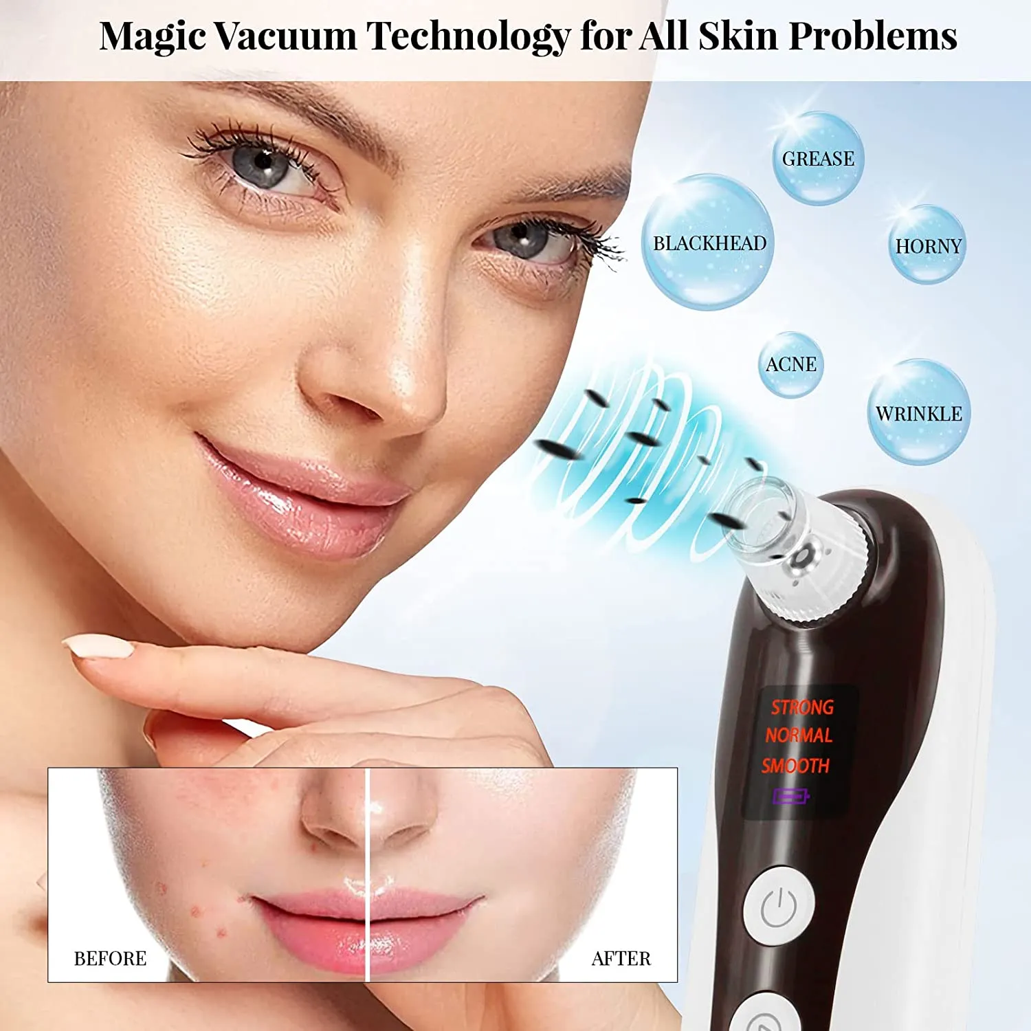 Blackhead Remover Pore Vacuum with Camera with Kit Suction Model MB7612